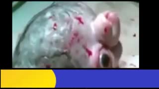 خلقت عجیب در بیمارستان راضی اهواز