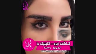 فیلم کاشت ابرو | کلینیک رز | 02148679 | شماره 224