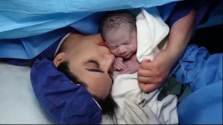 عمل زایمان سزارین