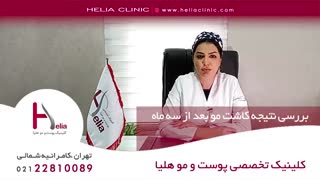 بررسی نتیجه کاشت مو بعد از سه ماه | کلینیک هلیا