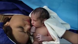 فیلم واقعی زایمان سزارین