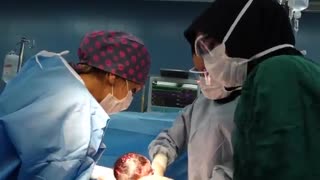 فیلم عمل زایمان سزارین