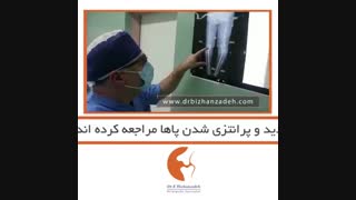فیلم تعویض مفصل زانو در خانم 60 ساله