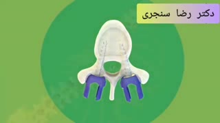 جراحی اسکولیوز