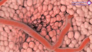 بیماری های خود ایمن