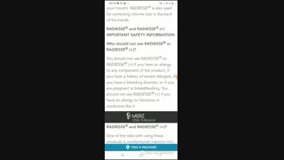 فیلر رادیس نیمه دایمی  با  www.ebiderm.blogfa.com