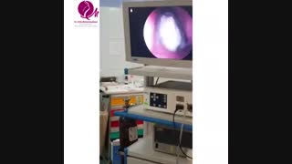 یافته جدید در بینی