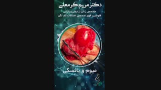 میوم و یائسگی