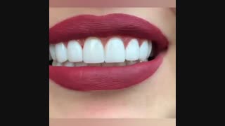 انجام 8 واحد لمینیت سرامیکی