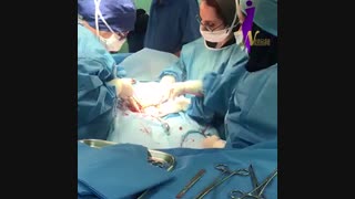 فیلم زایمان سزارین دوم کیاشا