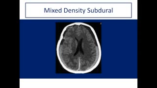 Introduction to CT Head: Approach and Principles