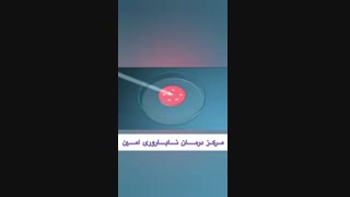 نحوه انجام آی وی اف