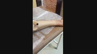 درمان فلج عصب سیاتیک | 02122885090