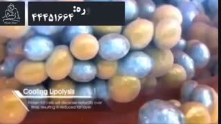 کرایولیپولیز 7