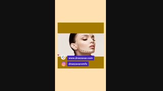 فیلم  زاویه سازی فک