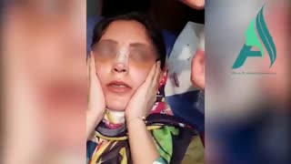 نحوه چسب زدن بینی و فرم نهایی چسب بینی