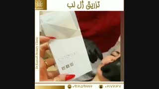 فیلم واقعی تزریق ژل لب