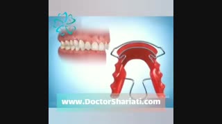 درمان ناهنجاری های فکی با ارتودنسی