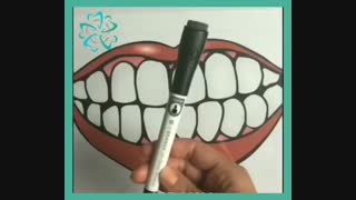 مراقبت از دندان کودکان