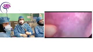 فیلم واقعی نشت مایع مغزی نخاعی