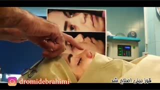 جراحی بینی پهن توسط دکتر امید ابراهیمی بهترین جراح بینی در تهران