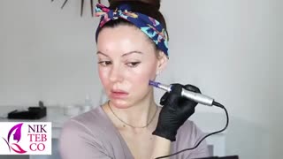 آموزش مزوتراپی یا میکرونیدلینگ روی صورت خودمان