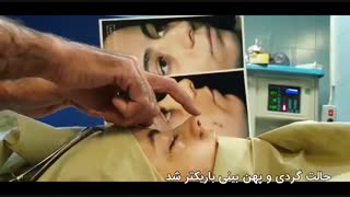 فیلم عمل بینی استخوانی