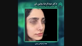 جراحی بینی | فوق تخصص جراحی پلاستیک | دکتر عبدالرضا روئین تن