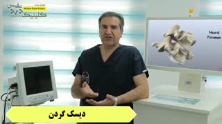 علائم دیسک گردن