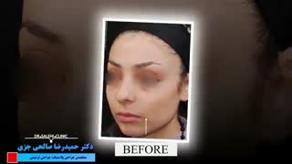 فیلم عمل واقعی بینی