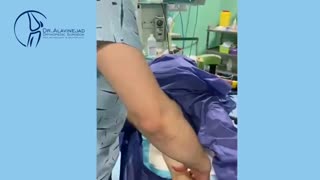 فیلم نتیجه عمل تعویض مفصل زانو به روش هینج گذاری