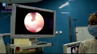 اندوسکوپی مغز در دختر خانم ۱۶ ساله