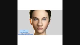 انیمیشن چگونگی جراحی بینی گوشتی