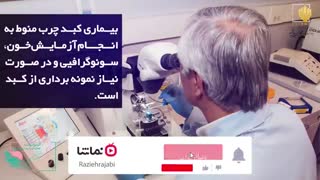 نقش تغذیه در درمان کبد چرب