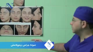 فیلم عمل جراحی زیبایی بینی