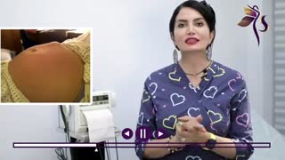 حرکات جنین در بارداری