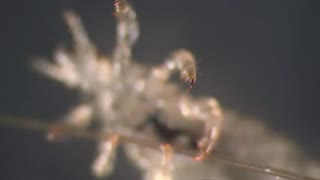 درمان رشک سر با شامپو دی فنوترین | D – phenothrin