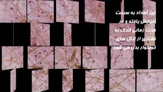 چطور از شر شپش خلاص شویم | شامپو ضد شپش دیفنوترین D-phenotrine