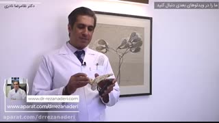 روش های درمان پیچ خوردگی مچ پا