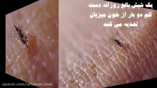 تشخیص و درمان شپش با شامپو شپش خارجی | دیفنوترین D-phenotrine