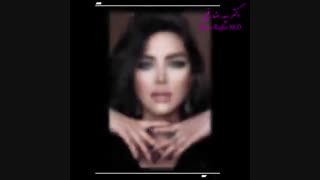 نمونه کارهای جراحی بینی دکتر سید رضا رفیع | جراح بینی تهران