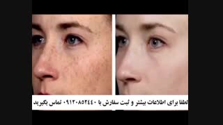 قیمت کرم ضد لک صمیم چنده زاویه سازی صورت