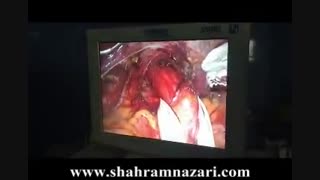 آشالازی
