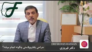 اطلاعاتی درباره جراحی بلفاروپلاستی