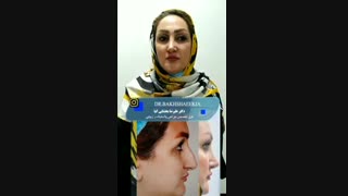 فیلم عمل بینی استخوانی قوزدار