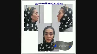 فیلم جراحی بینی ترمیمی