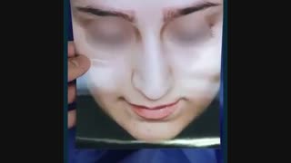 فیلم واقعی عمل بینی