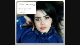 لیفت سانترال لب