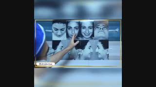 فیلم جراحی زیبایی بینی