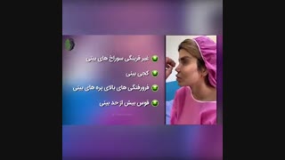 سه ماه بعد از جراحی ترمیمی بینی | دکتر باستانی نژاد | جراح بینی تهران